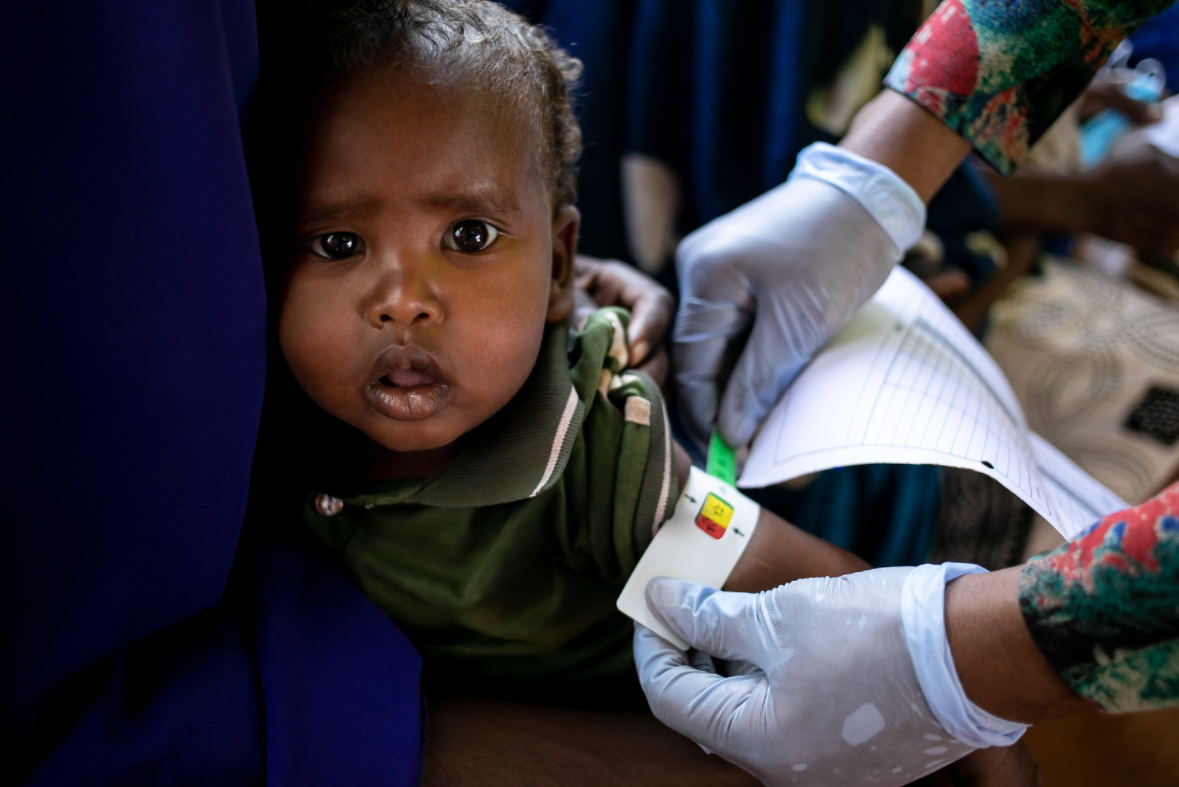 <p><sub>Somalia: Bei einem Kind wird der Umfang des mittleren Oberarms gemessen, um Anzeichen von Unterernährung festzustellen, 3. Februar 2022, Gesundheitszentrum von Dolow.<br />UNICEF setzt seine lebensrettende Hilfe in den von Dürre betroffenen Gebieten fort und arbeitet mit Familien, lokalen Gemeinschaften, Organisationen und Regierungen in ganz Somalia zusammen.</sub></p>